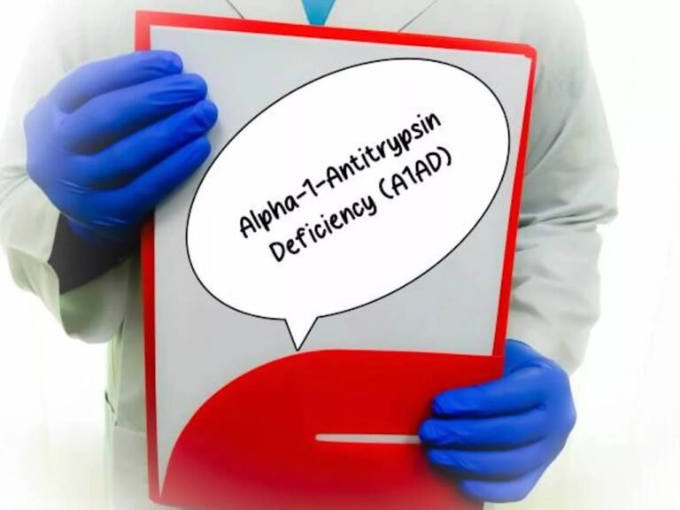 Alpha-1 Antitrypsin Deficiency: Lung and Liver Effects