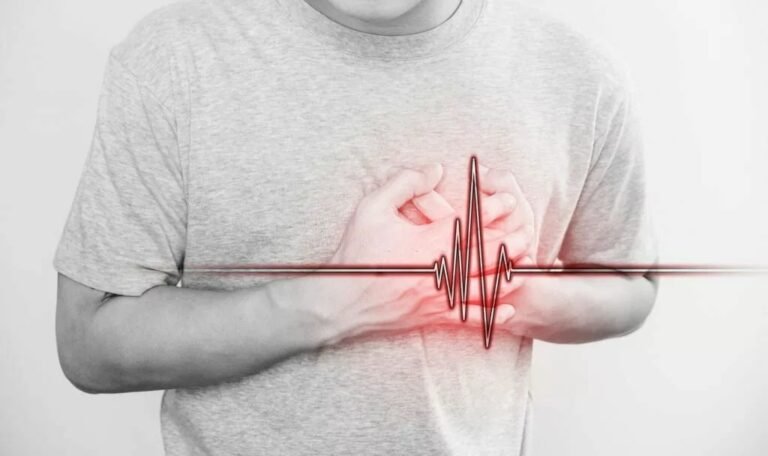 Brugada Syndrome – Understanding the Silent Threat