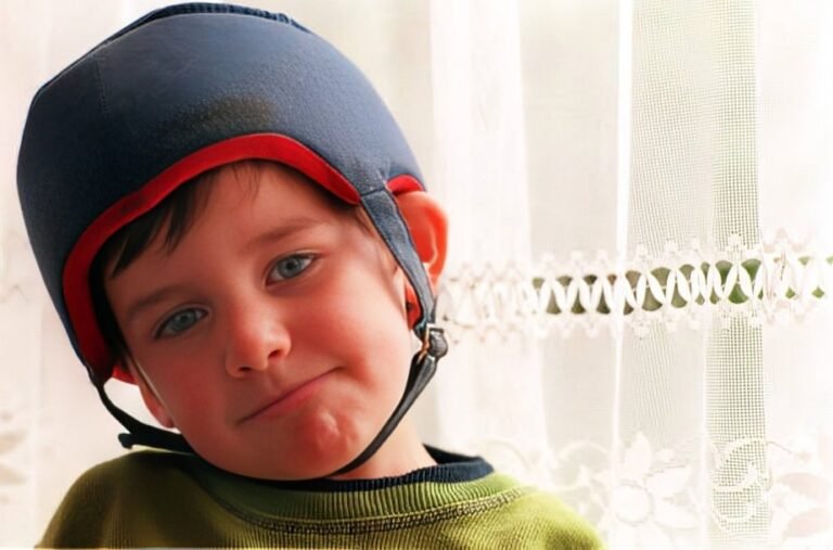 Lennox Gastaut Syndrome: Understanding The Complexity