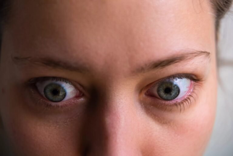 Graves Eye Disease: Symptoms, Risks & Treatment Options
