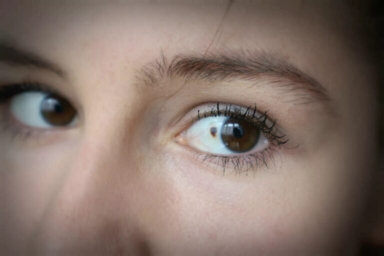 Alkaptonuria: Causes, Symptoms & Treatment Options