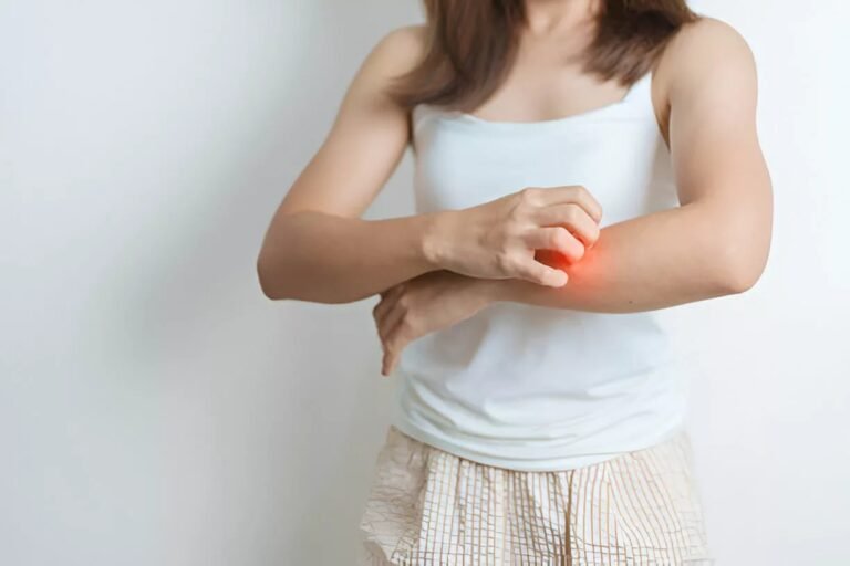 Brachioradial Pruritus: Managing the Itch and Sensory Changes