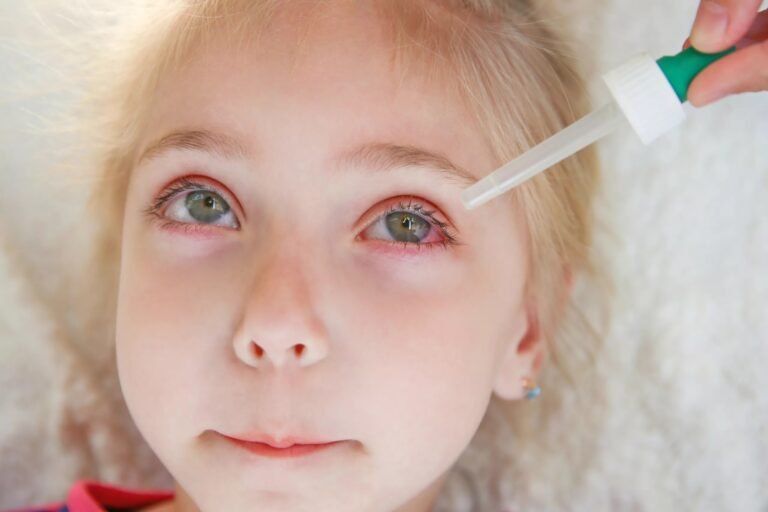Allergic Conjunctivitis: Symptoms & Relief