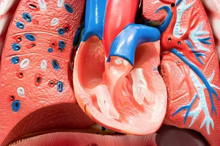 What is Aortic Valve Sclerosis? Exploring Causes, Symptoms & Solutions