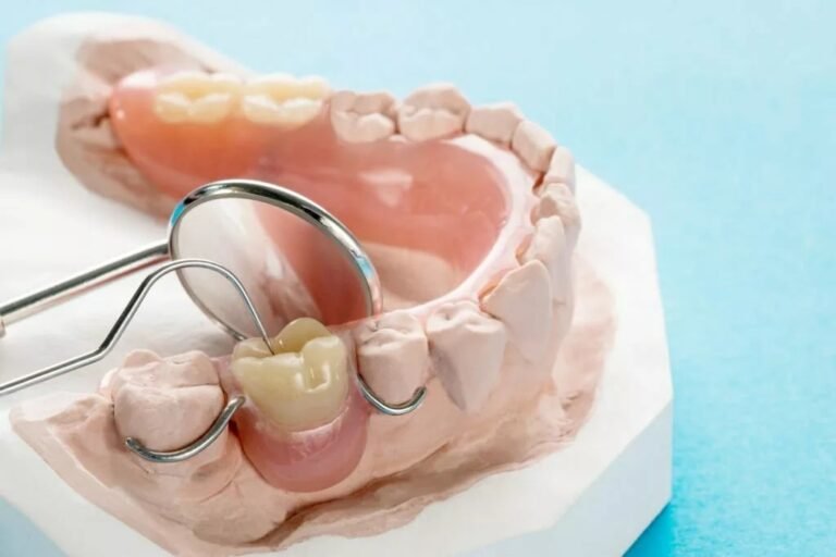 What are Removable Partial Dentures? A Comprehensive Guide