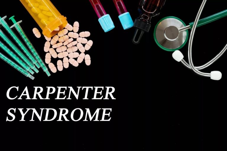 Carpenter Syndrome: Causes, Symptoms, and Treatment Options