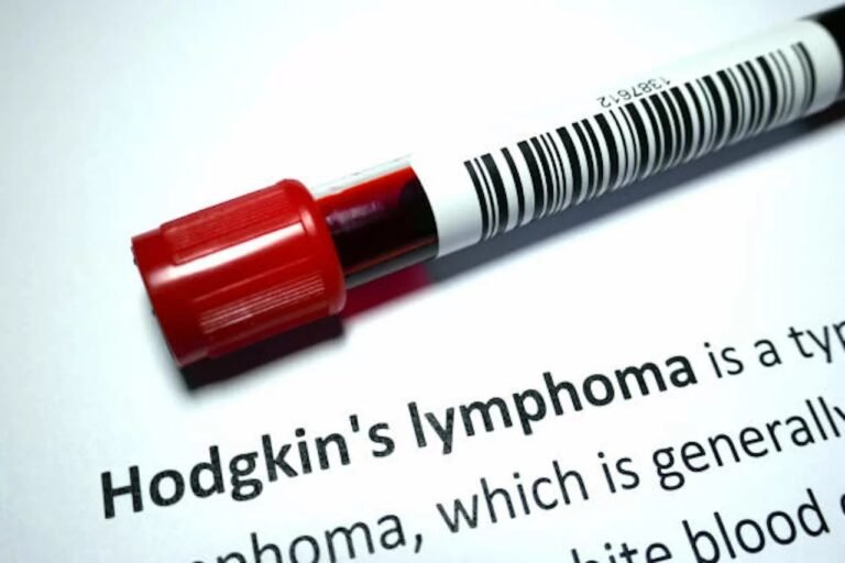 Classical Hodgkin Lymphoma: Signs, Causes, and Care