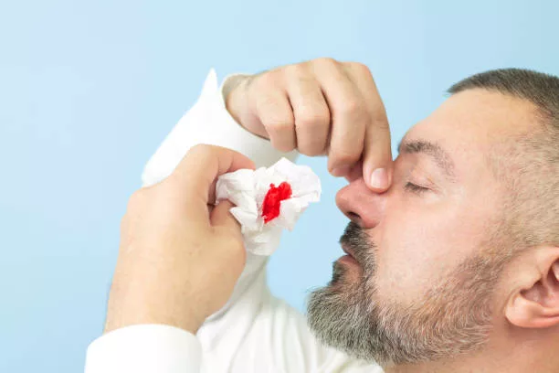 Esthesioneuroblastoma: Secrets of a Rare Nasal Tumor