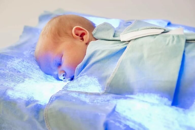 Crigler Najjar Syndrome: Understanding a Rare Condition