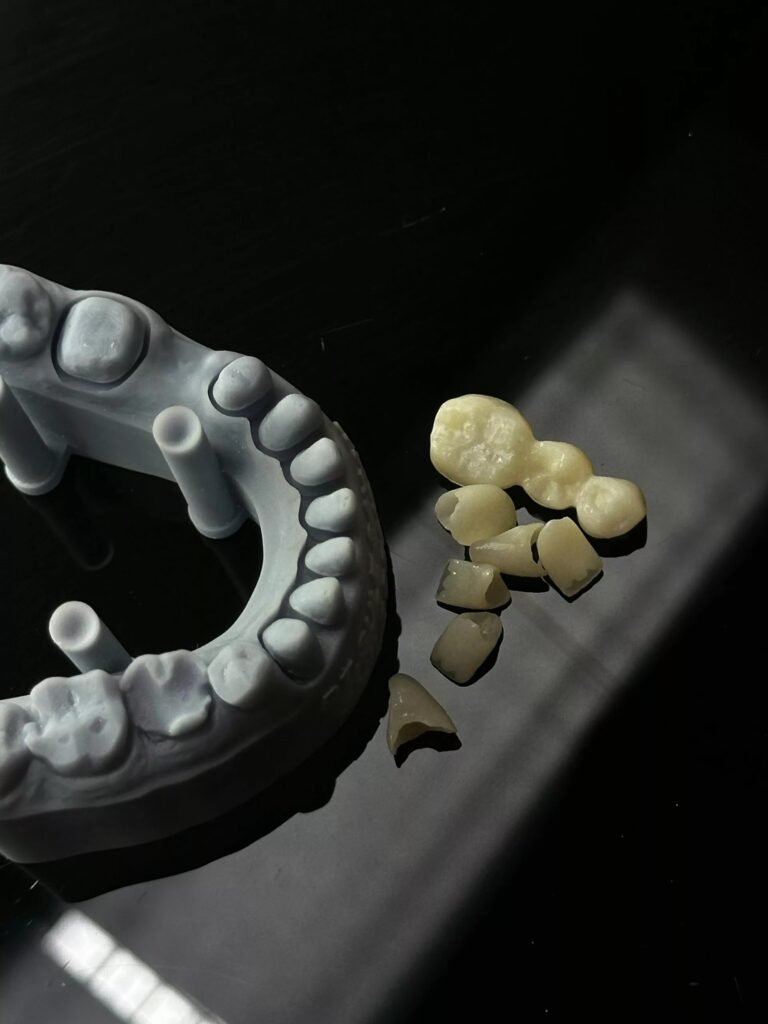 Dental Bridge: Types, Procedure And Care