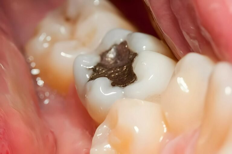 Dental Filling: Your Guide to Strong, Healthy Teeth