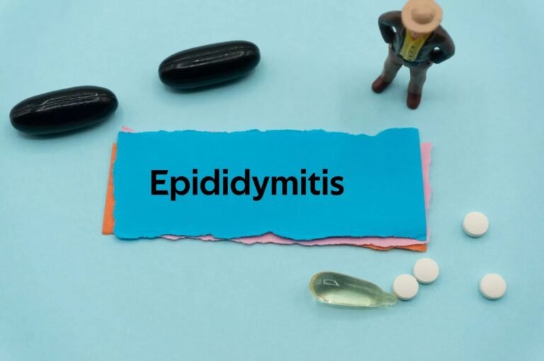 Epididymitis: Causes, Symptoms, and When to Seek Help