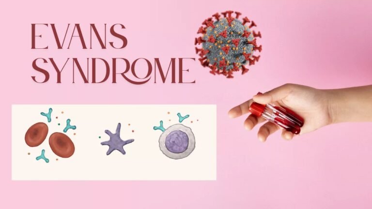 Evans Syndrome: Causes, Symptoms, and Treatment Options