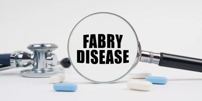 Fabry Disease: Insights into a Rare Condition