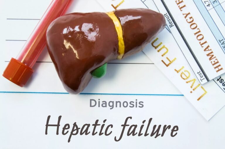 Fulminant Hepatic Failure: What You Need to Know