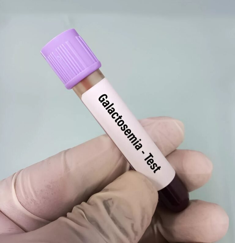 Galactosemia: Symptoms, Causes, and Treatments of this Rare Illness