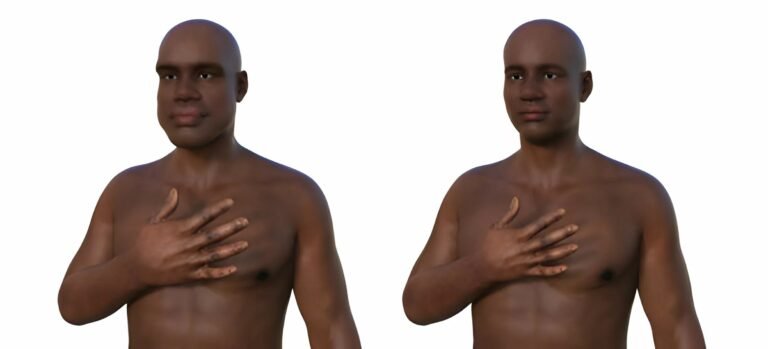 Gigantism: The Truth Behind Extraordinary Growth