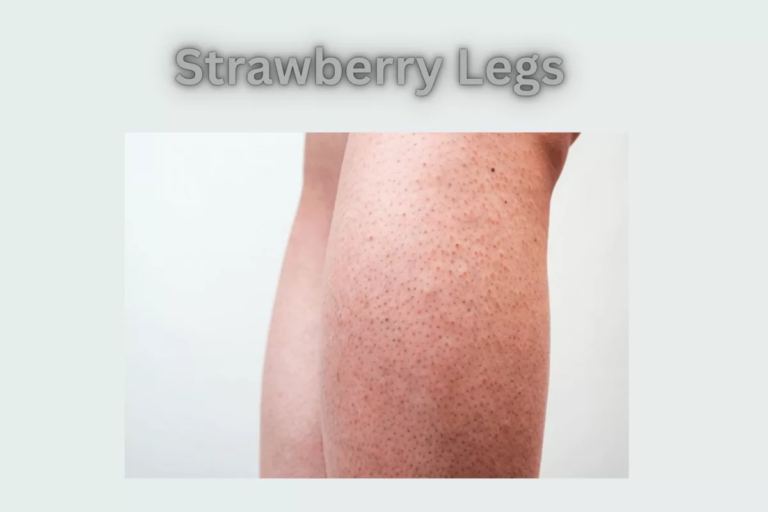 How to Get Rid of Strawberry Legs: Causes, Treatments, and Prevention