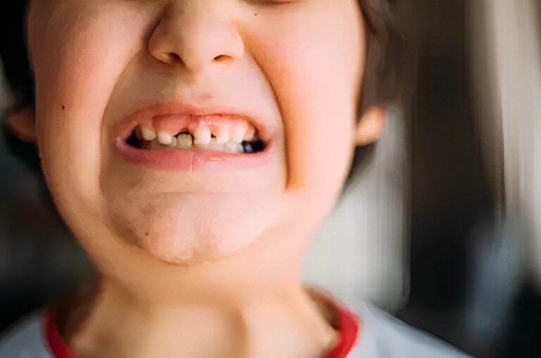 Hypophosphatasia: Understanding A Rare Genetic Disorder
