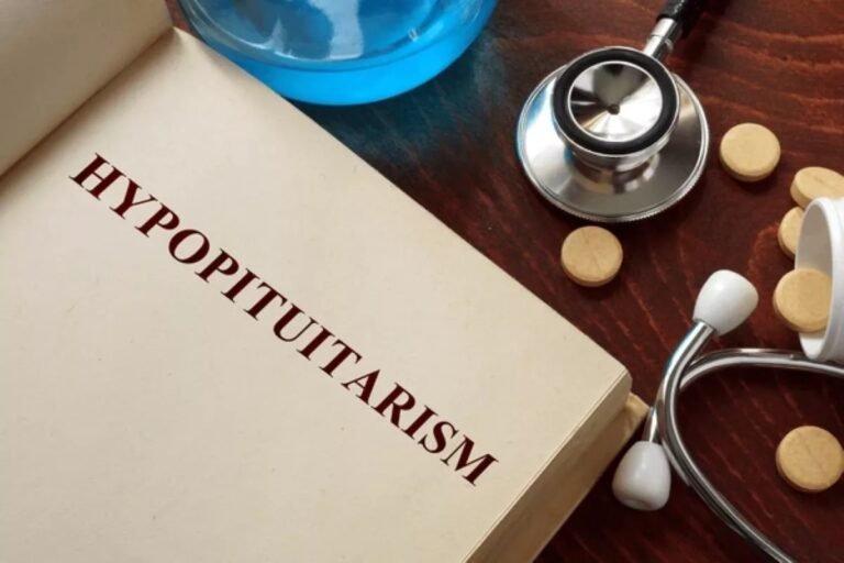 Hypopituitarism: Symptoms, Causes, Diagnosis, and Treatment