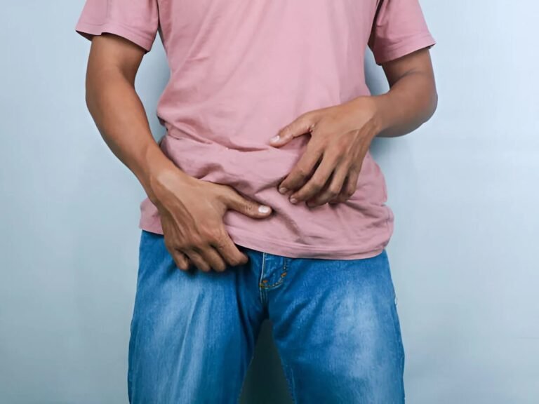 Jock Itch: Causes, Symptoms, and How to Treat It