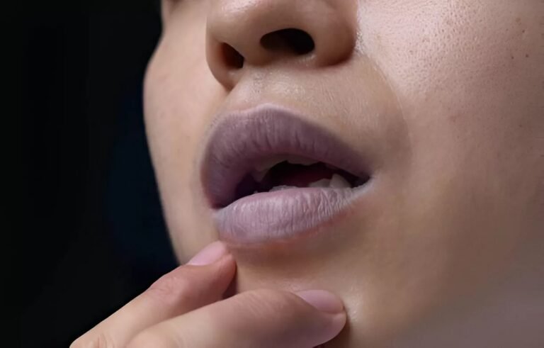 Methemoglobinemia: Causes, Symptoms, and Treatment