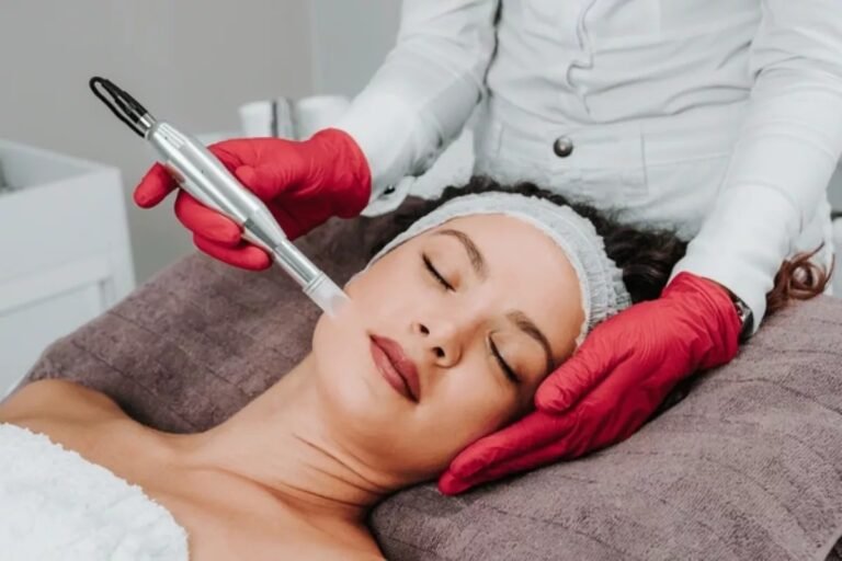 Microneedling with PRP: How the “Vampire Facial” Improves Skin and Hair