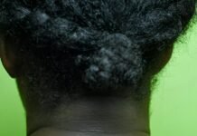 Acanthosis Nigricans: What You Need to Know