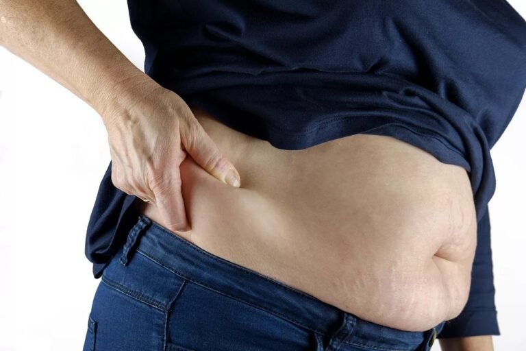 Pickwickian Syndrome: Causes, Symptoms, and Care