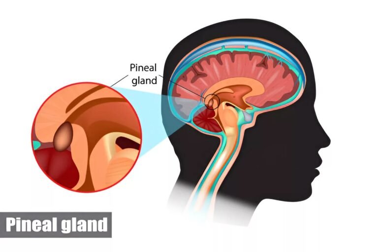 Pineoblastoma: Understanding This Rare Brain Tumor