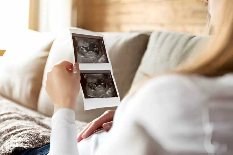Polyhydramnios: When Amniotic Fluid Is Too Much