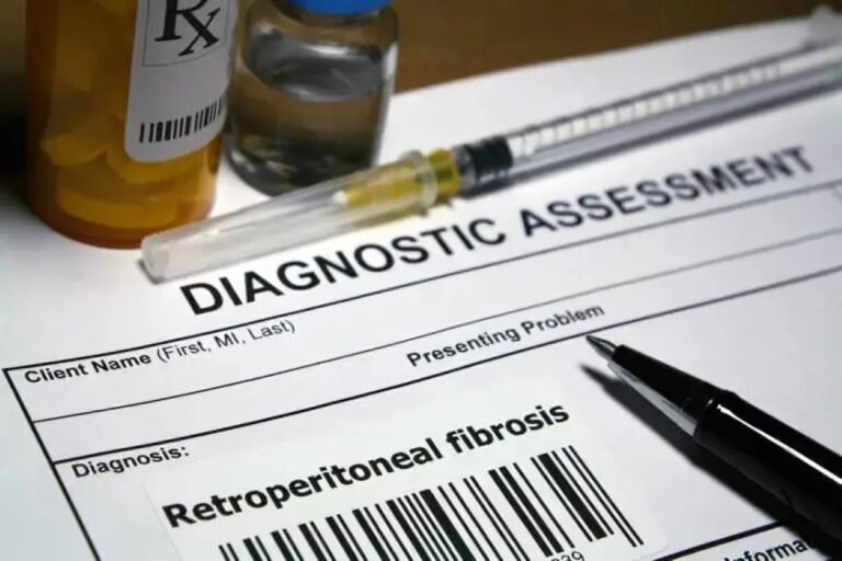 Retroperitoneal Fibrosis: Rare But Serious Condition