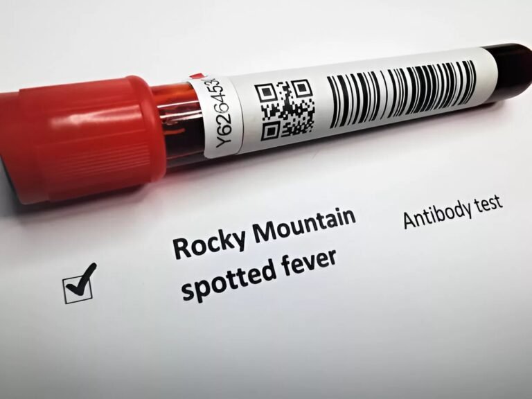 Rocky Mountain Spotted Fever: How to Stay Protected!