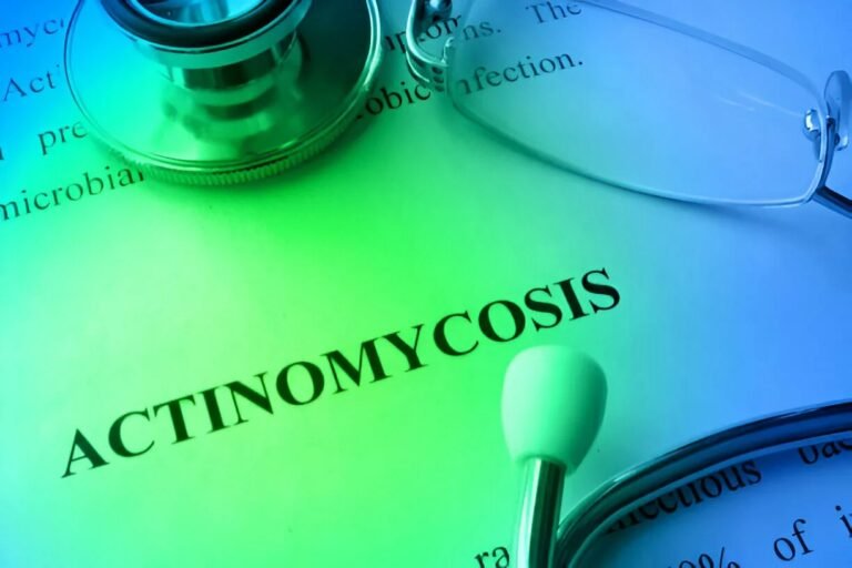 Actinomycosis: The Pus Draining Malady