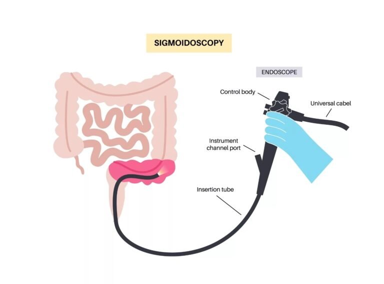 Sigmoidoscopy: A Key Procedure for Colon Health