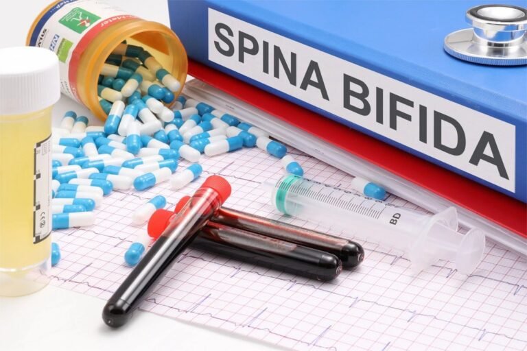 Spina bifida: Prevention, Treatment, and Early Diagnosis