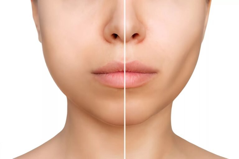 Sunken Cheeks: Why they happen and how to fix them?