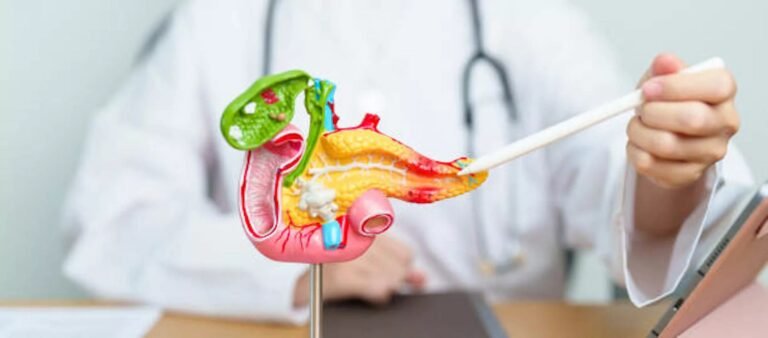 Acute Pancreatitis: Symptoms, Causes, and Treatment