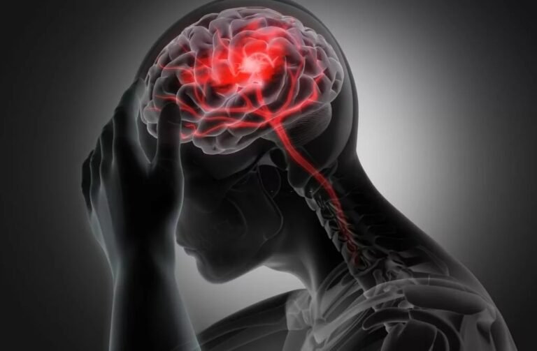 Traumatic Subarachnoid Hemorrhage: Causes, Symptoms & Care