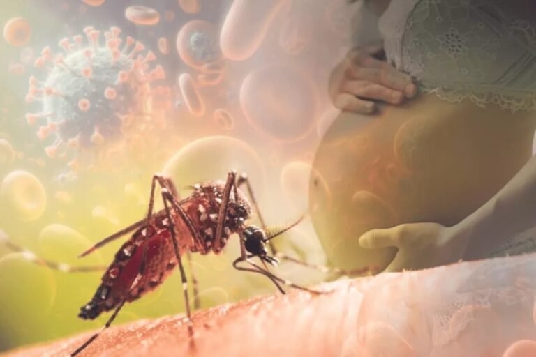 Zika Virus: Symptoms, Pregnancy Risks and Prevention