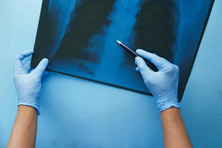 Pulmonary Contusion: Causes, Symptoms, and Care