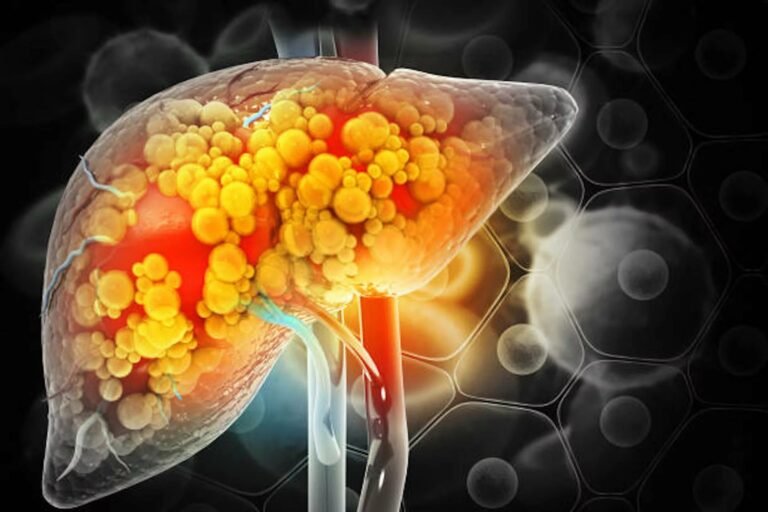 Hepatic Fibrosis: Causes, Stages, and Early Detection