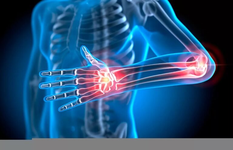 Medial Epicondylitis: Understanding Golfer’s Elbow and Its Treatment