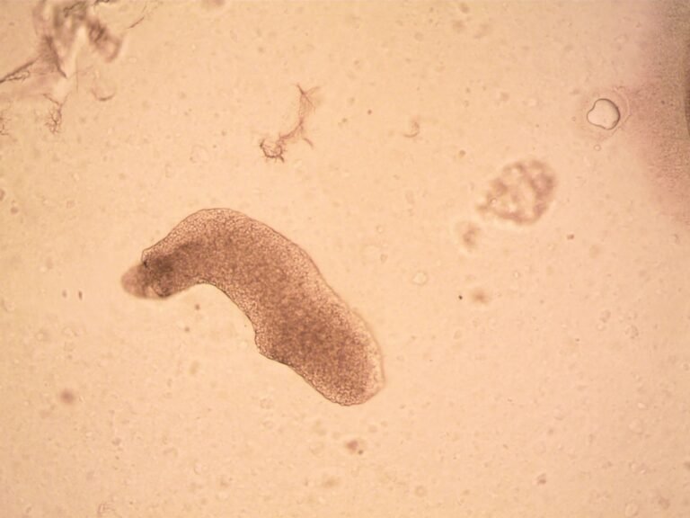 Amoebiasis: Causes, Symptoms & Prevention Essentials