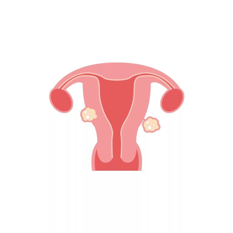 Subserosal Fibroids: Symptoms, Causes & Treatment Options