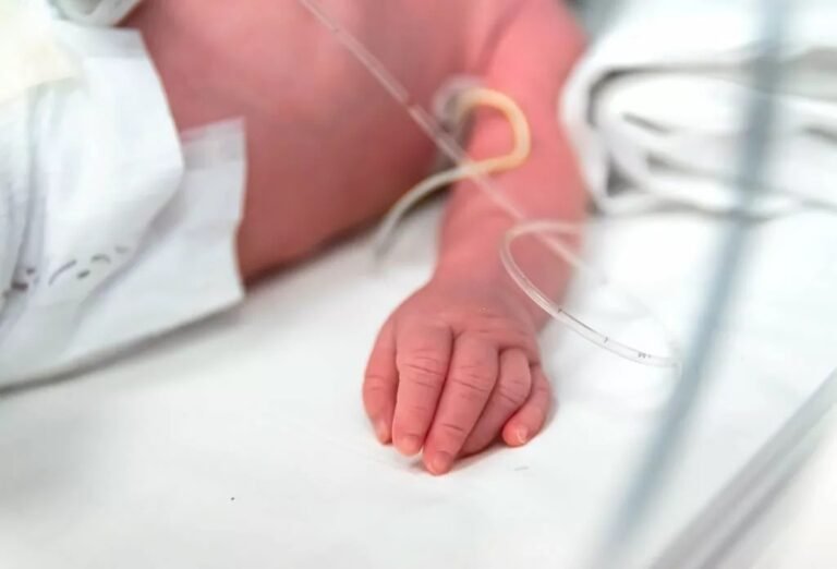 Zellweger Syndrome: Shedding Light on the Rare Genetic Disorder