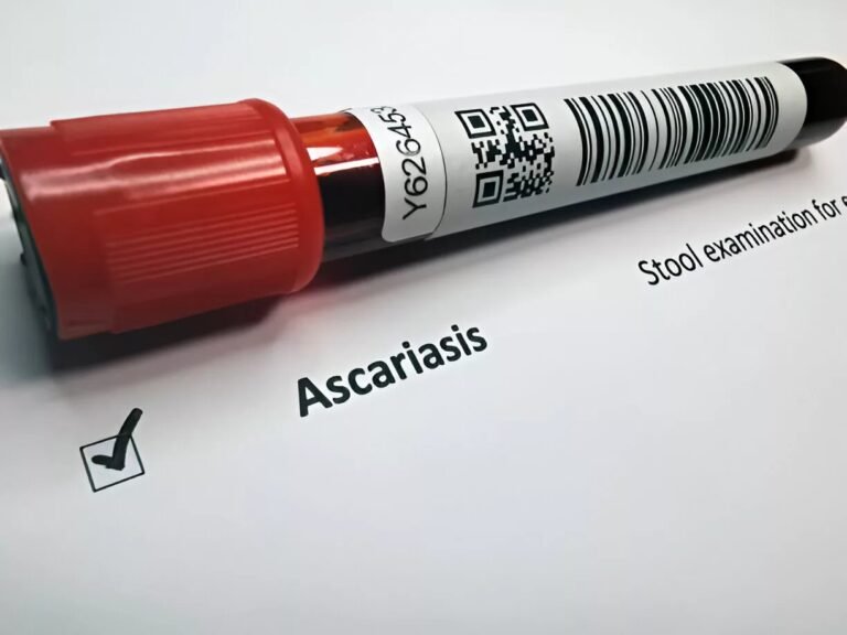 Ascariasis: Causes, Symptoms & Prevention Explained