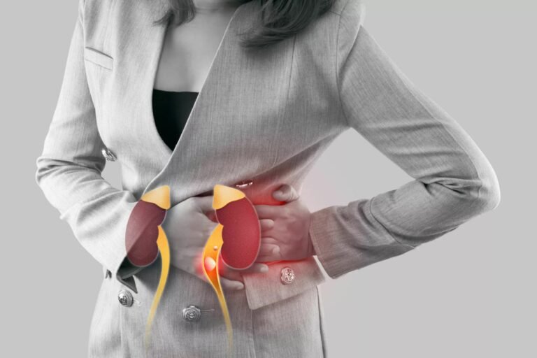 Nephrolithiasis:  Causes, Symptoms & Treatment