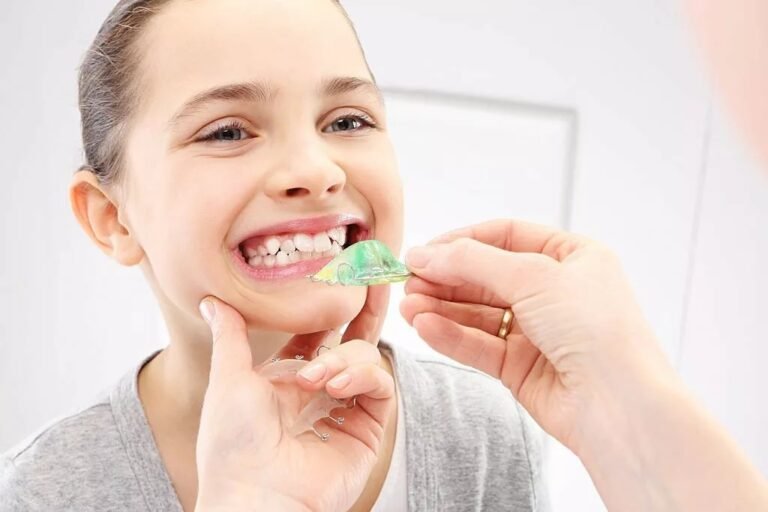 Malocclusion: Understanding Causes, Effects & Treatment Options