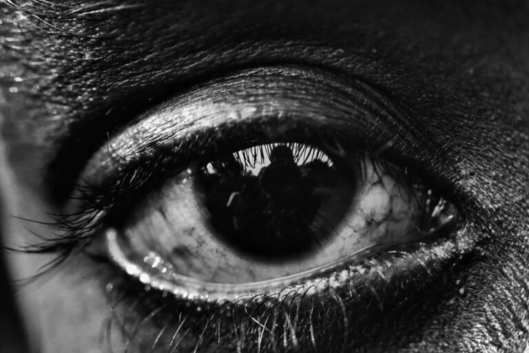 Retinal Detachment: A Medical Emergency Behind Painless Symptoms